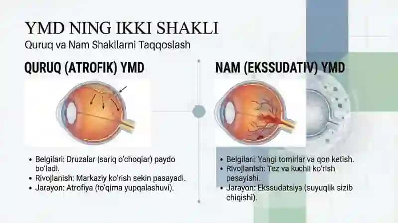 Ko’z to’r pardasi degenerativ kasalliklari 4
