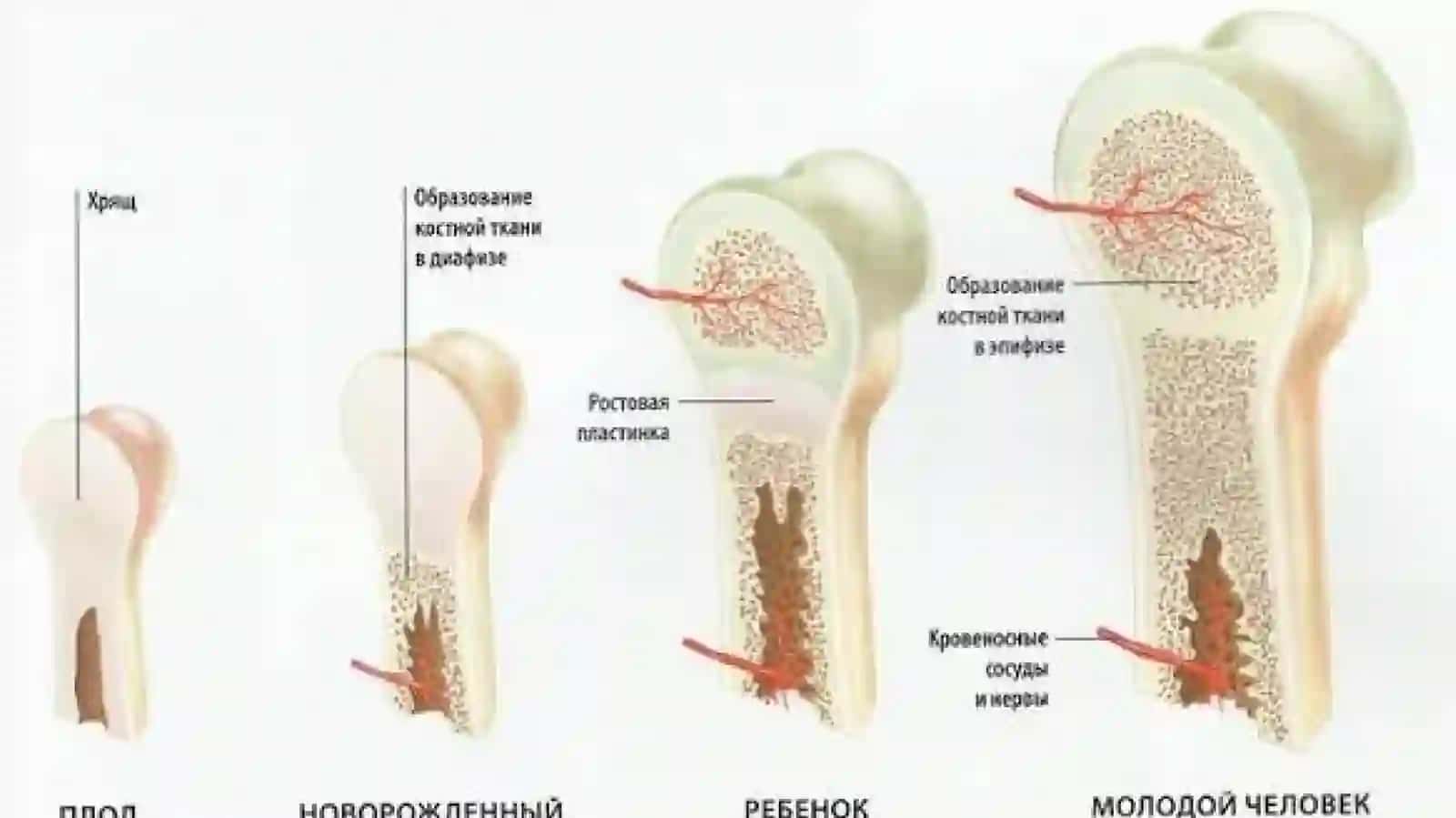 XONDRODISTROFIYA 4
