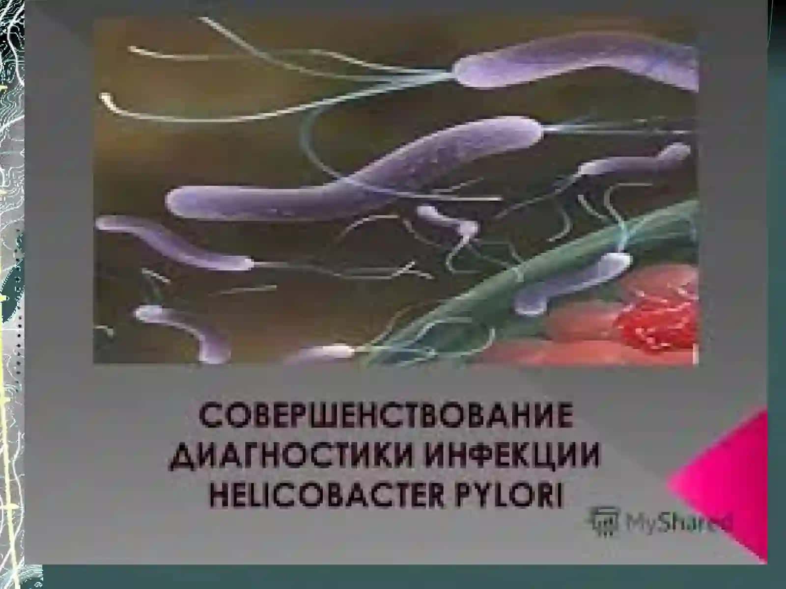 Язвенная болезнь  желудка и ДПК 4