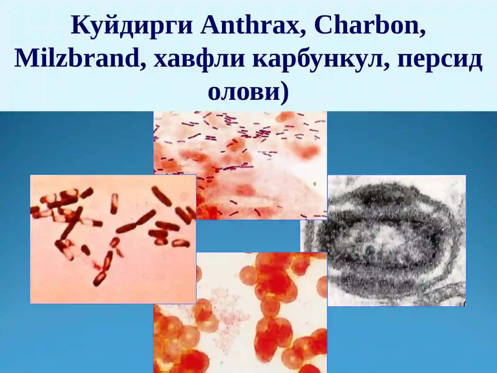 Ўта хавфли юкумли касалликлар 4