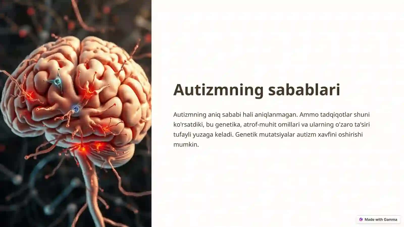 Autizm kasalligi haqida 4
