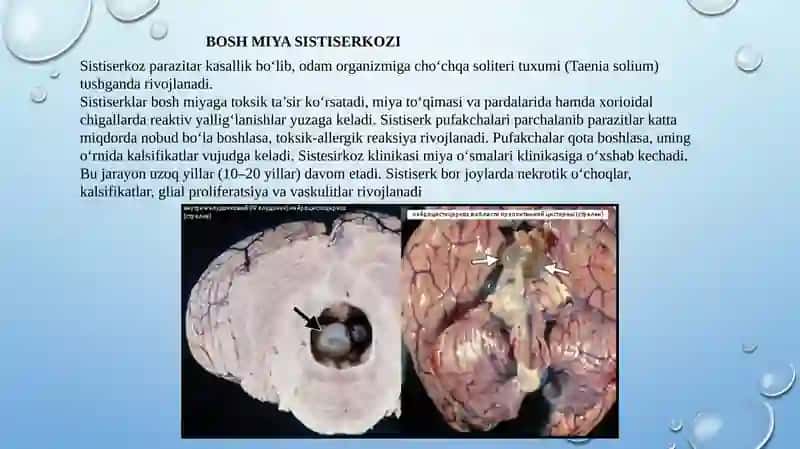 Boshmiyaning parazitar kasalliklari 4