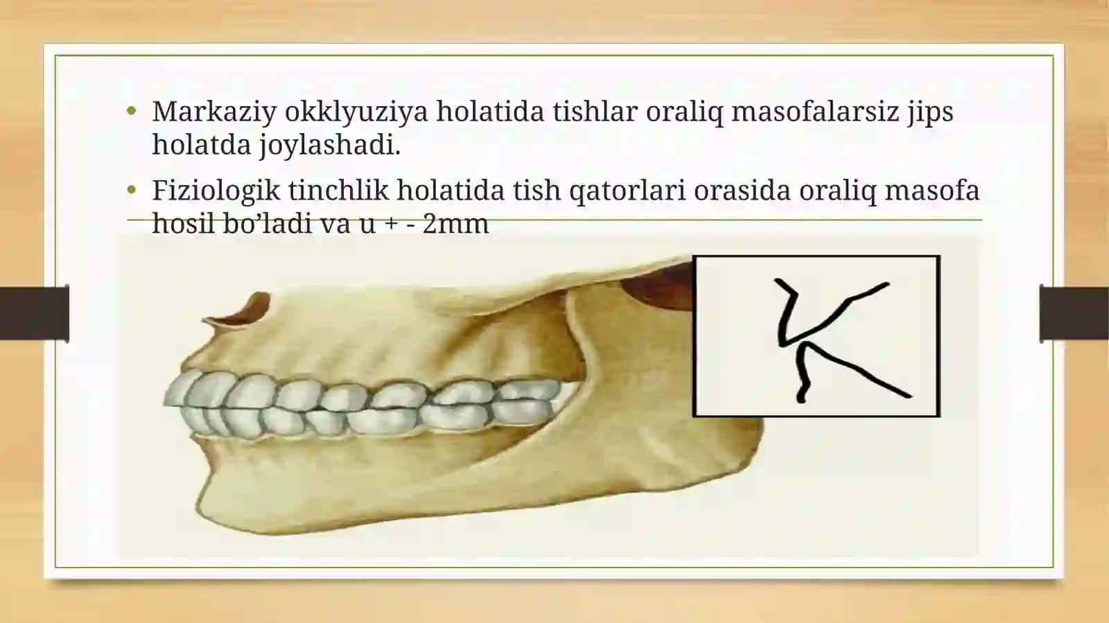Prikus va uning turlari 4