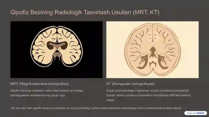 Endokrin Tizimi Radiologiyasi 4