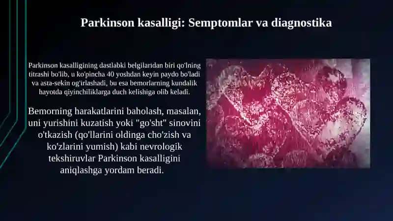 Altsgeymer va Parkinson kasalliklari 4