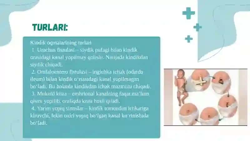 Kindikoqmalari 4