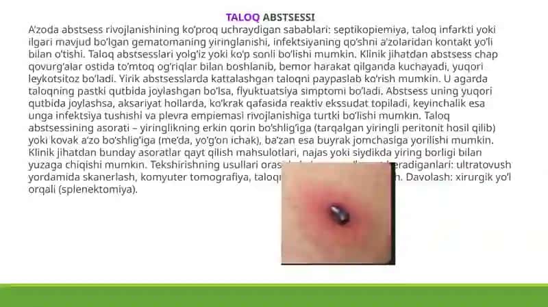 Taloqkasalliklari 4