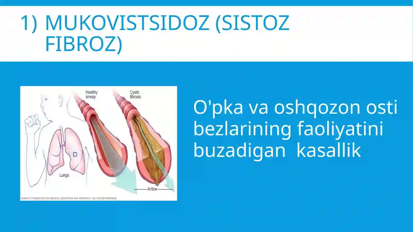 Mokovistsidoz (sistozfibroz0) 4