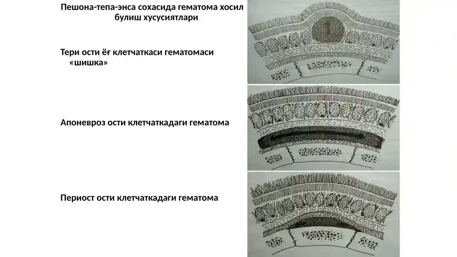 Бош сохаси клиник анатомияси 4