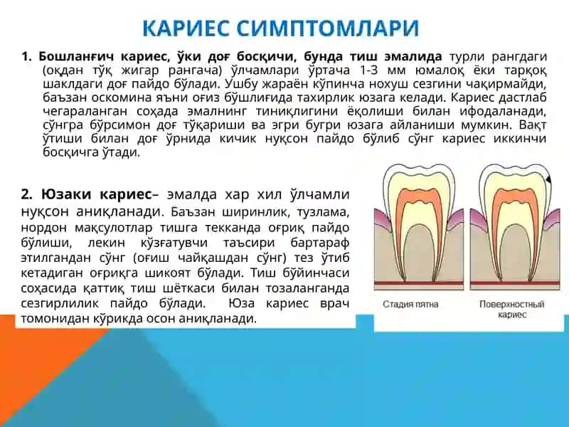 Оғизбўшлиғининг Профессионал гигиенаси. Кариес профилактикаси 4