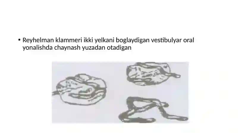 KLAMMERLAR ULARNI TURLARI VAZIFALARI 4