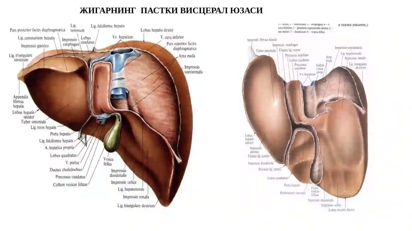 ЖИГАР РАКИ 4