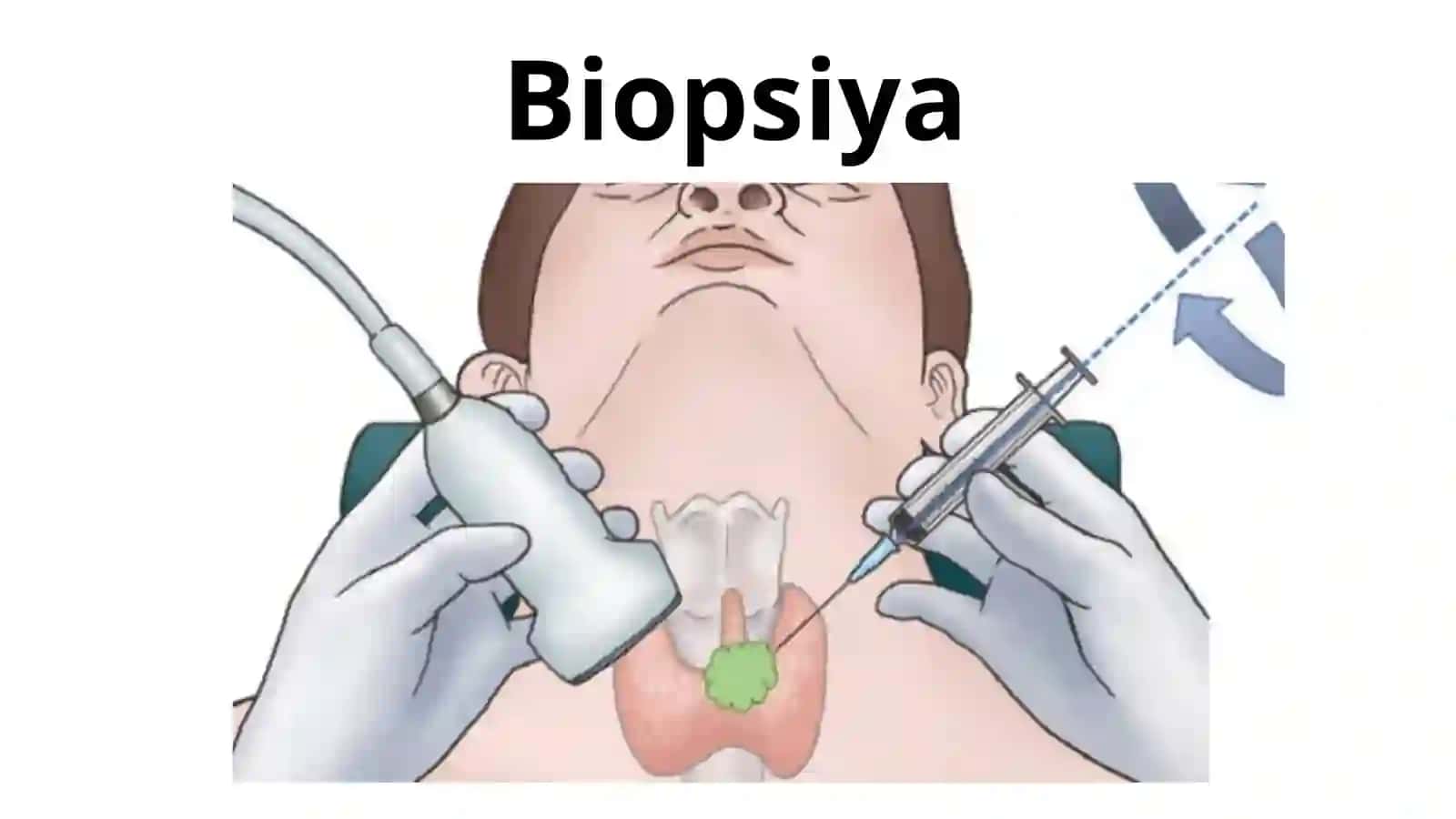 Patologik anatomiya moduliga kirish 4