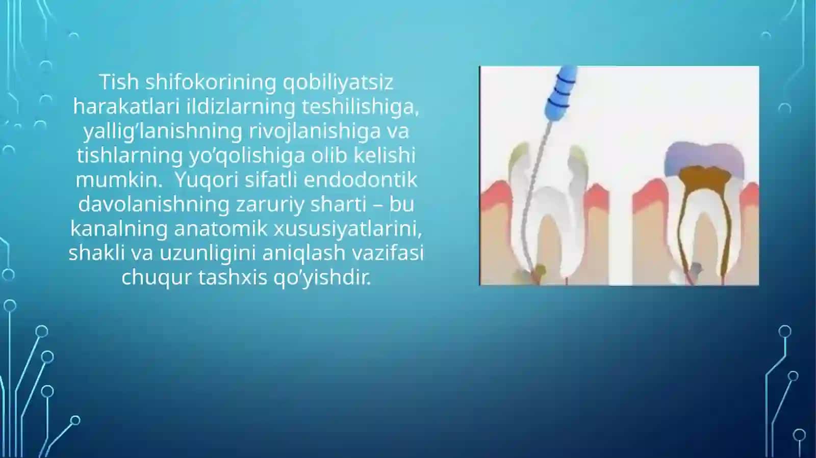 Kanalni plombalashda foydalaniladigan plomba ashyolari 4