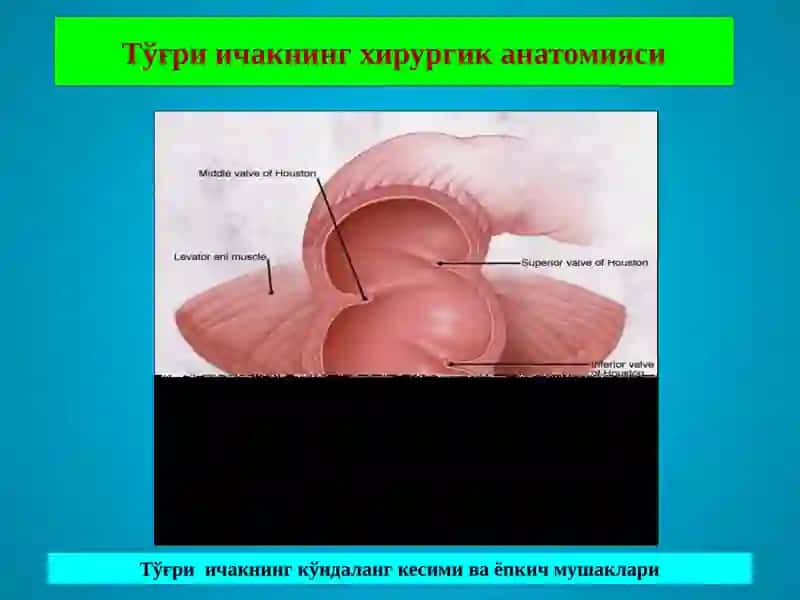 ТЎҒРИ ИЧАК КАСАЛЛИКЛАРИ 4