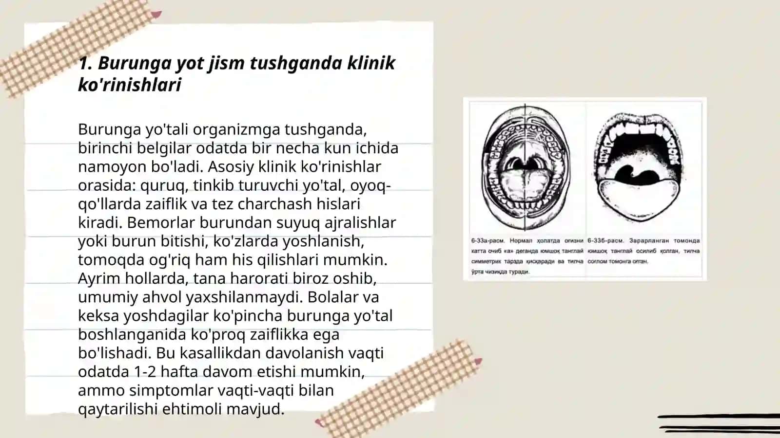 Burunga yot jism tushganda klinikasi,etiologiyasi, Differensial tashxis,va davolash 4