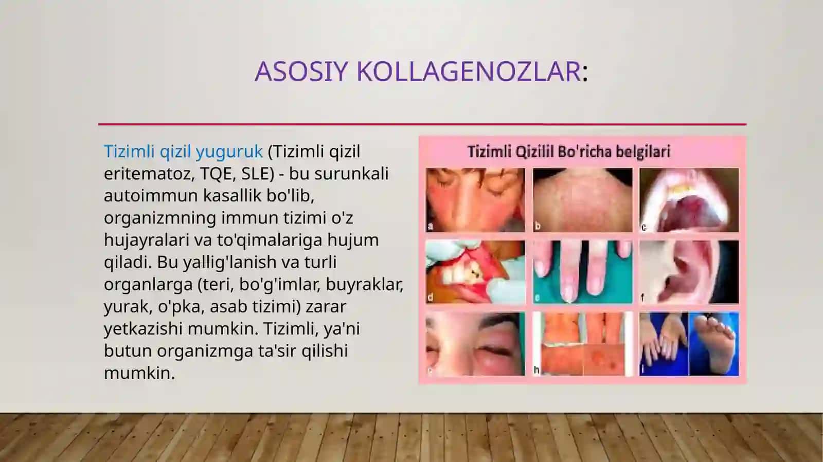 Kollegenozlar, patogenezi vatashxasi 4