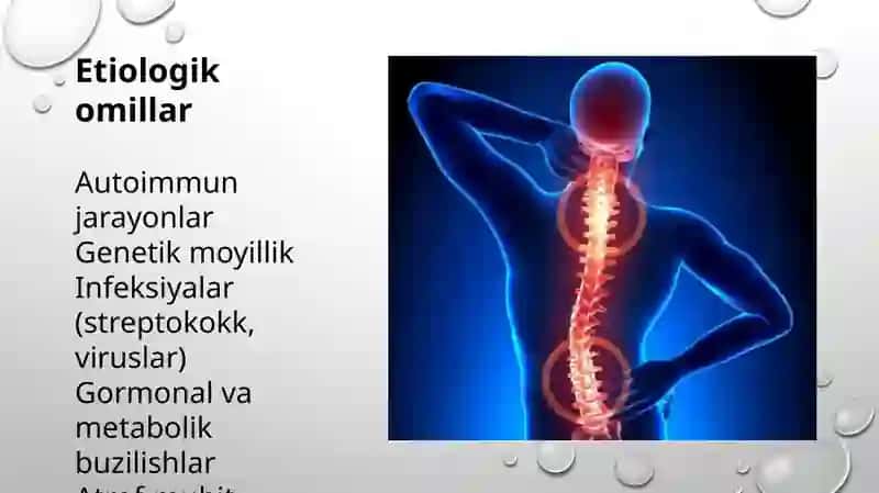 suyak va bo‘g‘imlarning tizimli kasalliklari 4