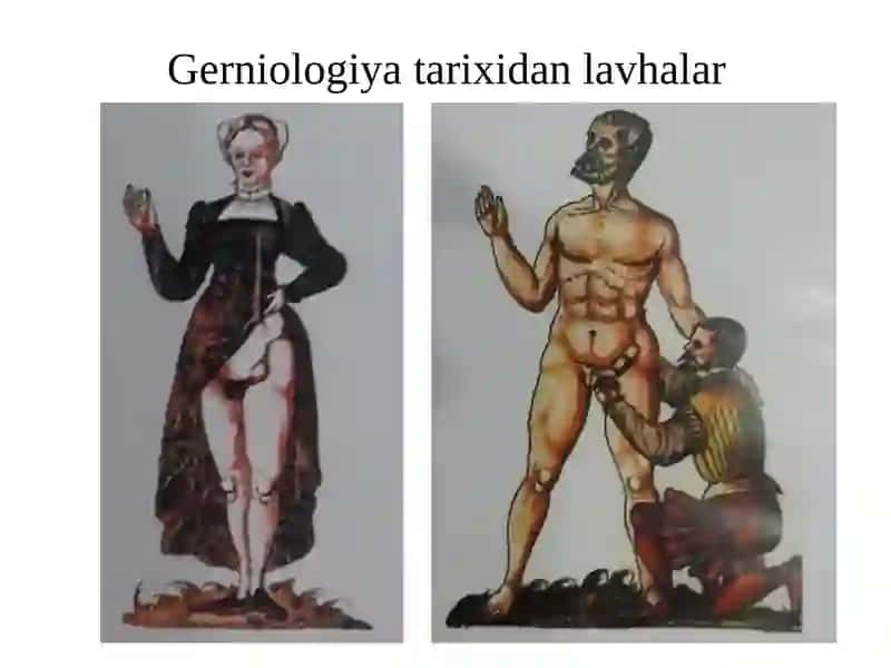 Qorin churralari va uning asoratlari 4
