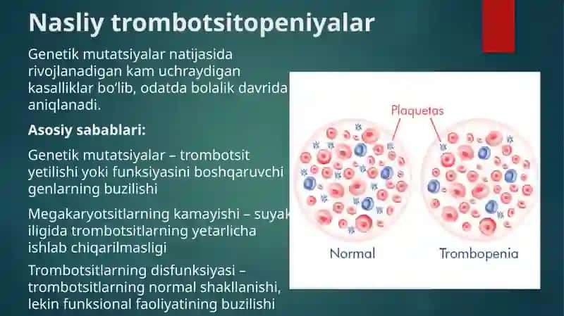 Nasliy va orttirilgan trombotsitopeniyalar 4