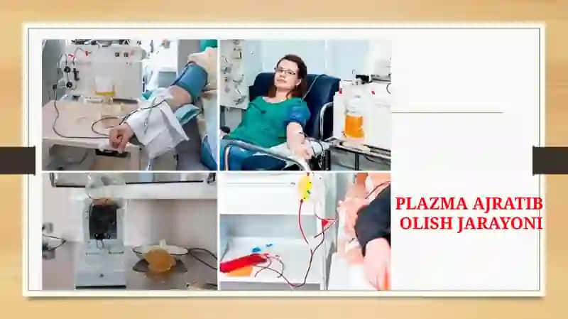 PLAZMOFEREZ 4