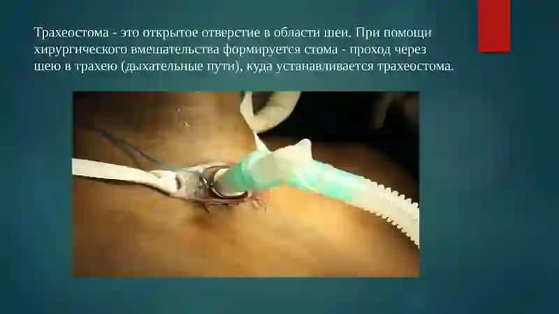 Презентация на тему"СТОМЫ" 4