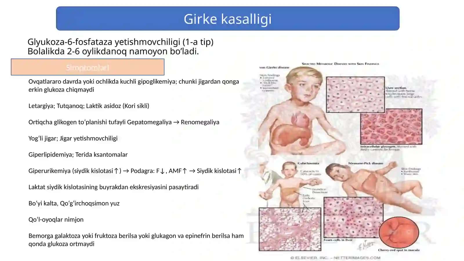 Glikogen kasalliklari 4