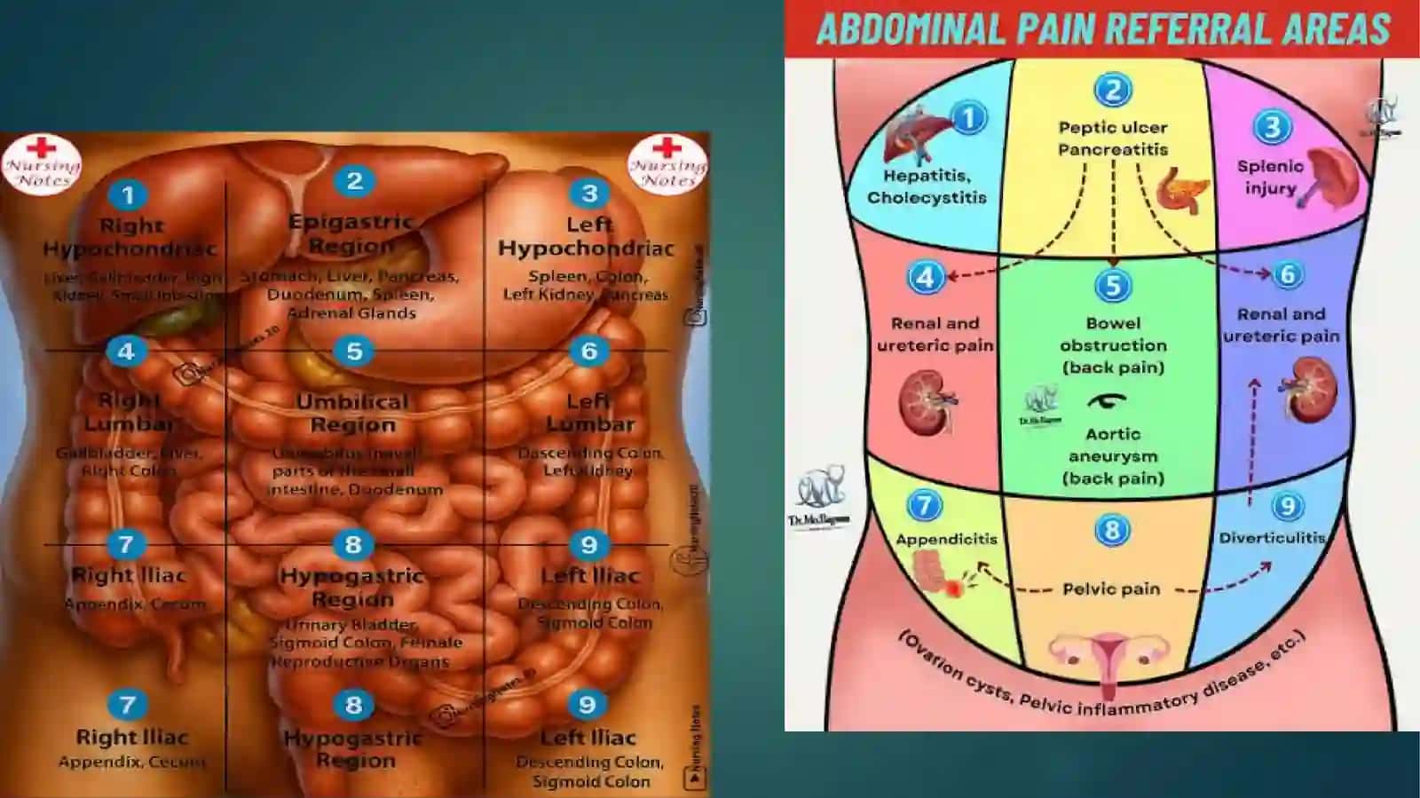 Acute Abdominal Syndrome: Modern Approaches to Diagnosis and Treatment 4