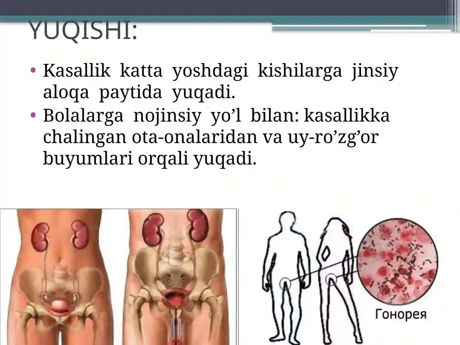 So'zak kasalligi 4