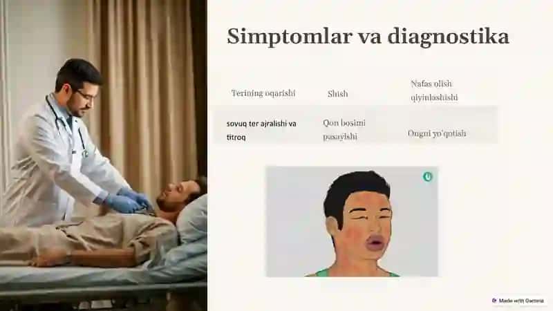 Anafilaktik shok va uni asoratlari 4
