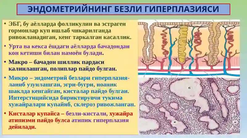 АЁЛЛАР ЖИНСИЙ АЪЗОЛАРИ 4