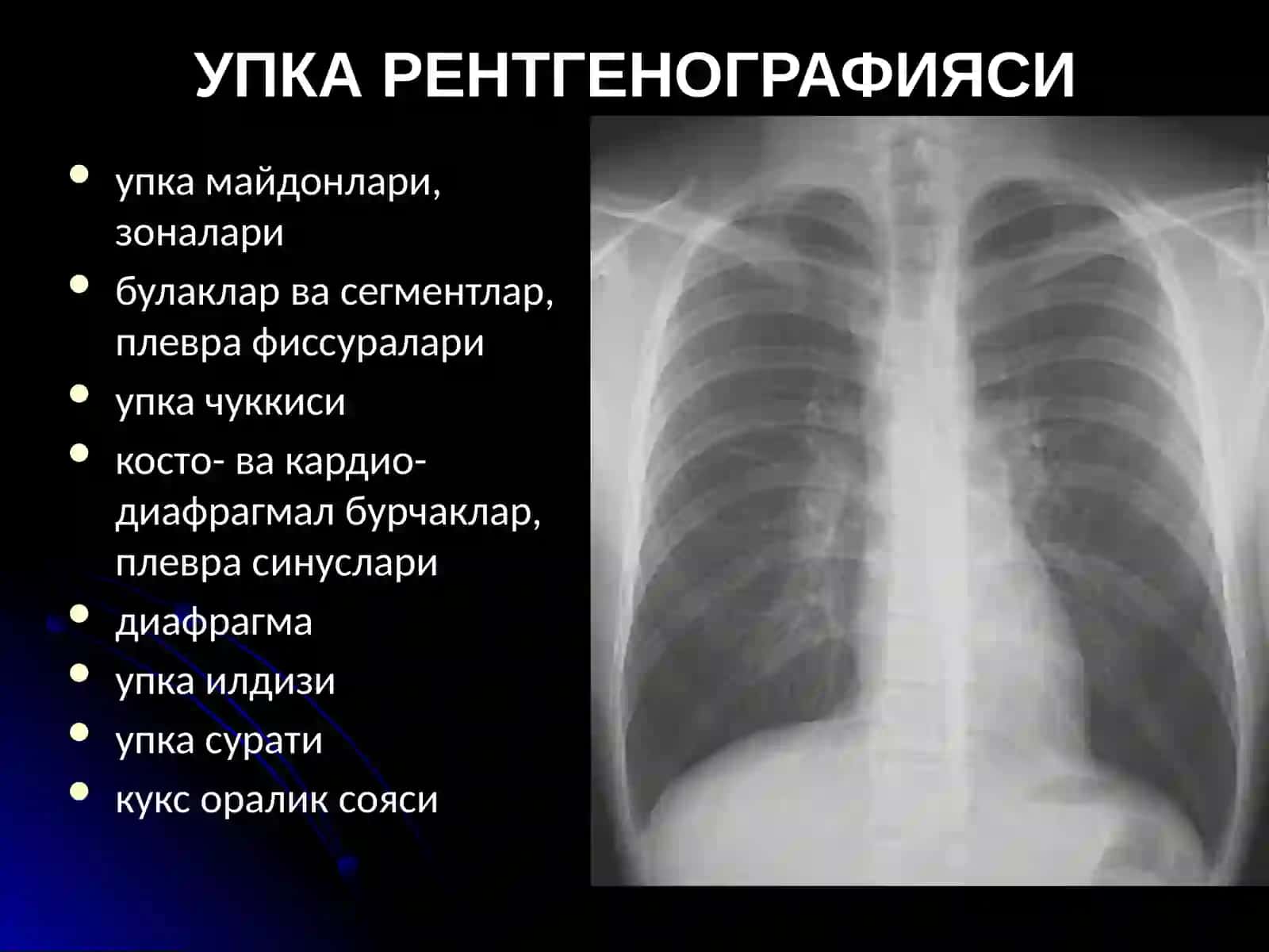 Упка касалликларининг нур ташхиси 4
