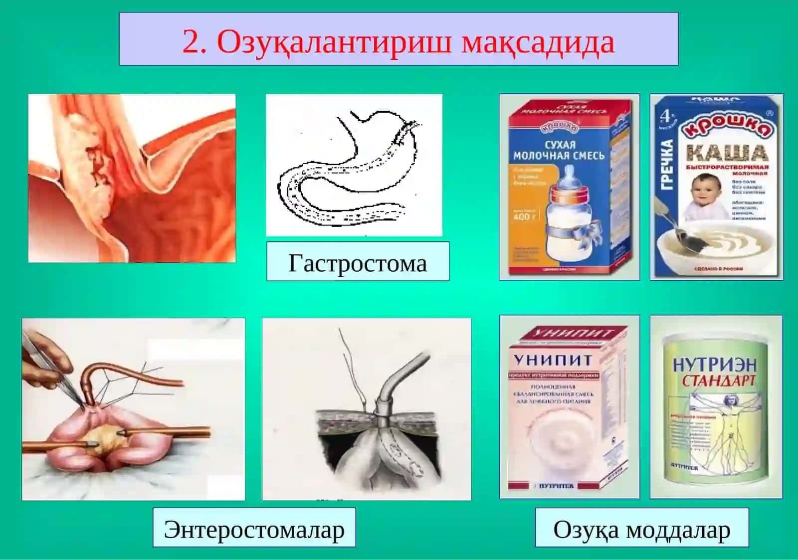 Ичак оқмалари 4