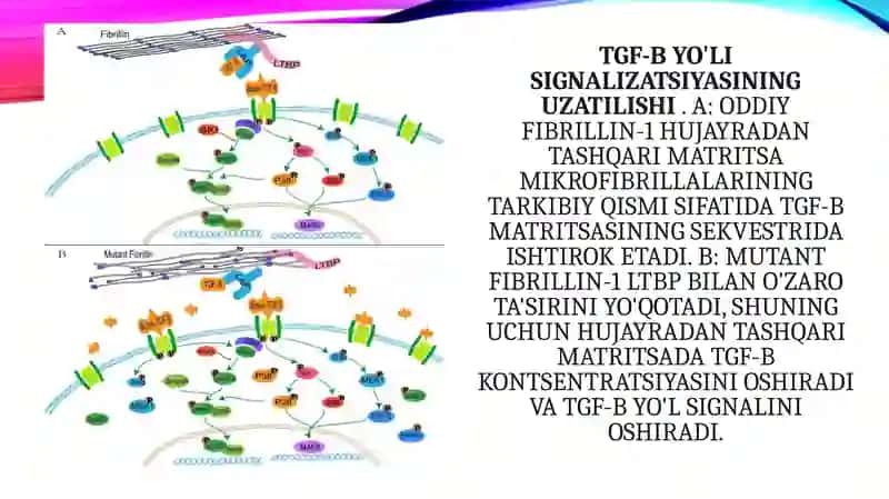 Marfansindromi 4