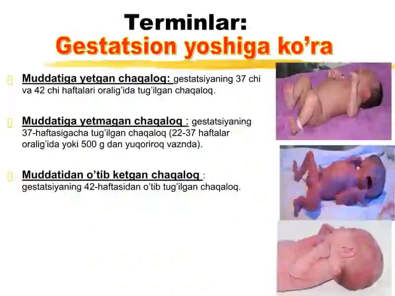 Neonatologiya haqida 4