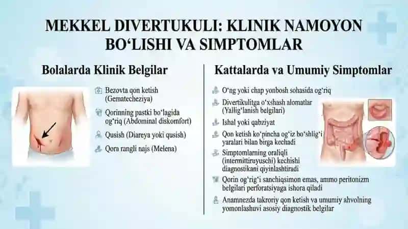 Mekkel divertikulini olish operatsiyasi 4