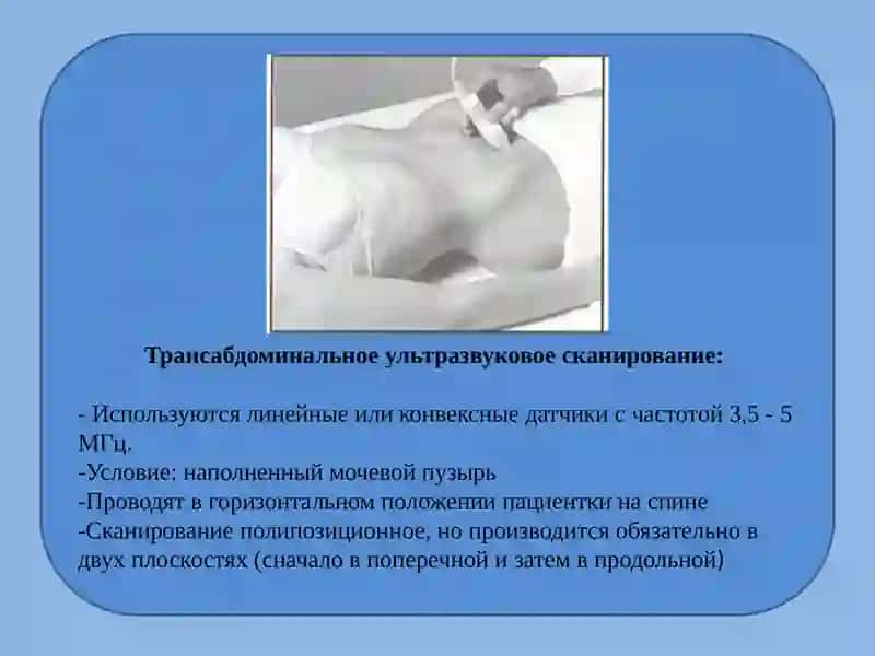 Ультразвуковое исследование в первом триместре беременности 4