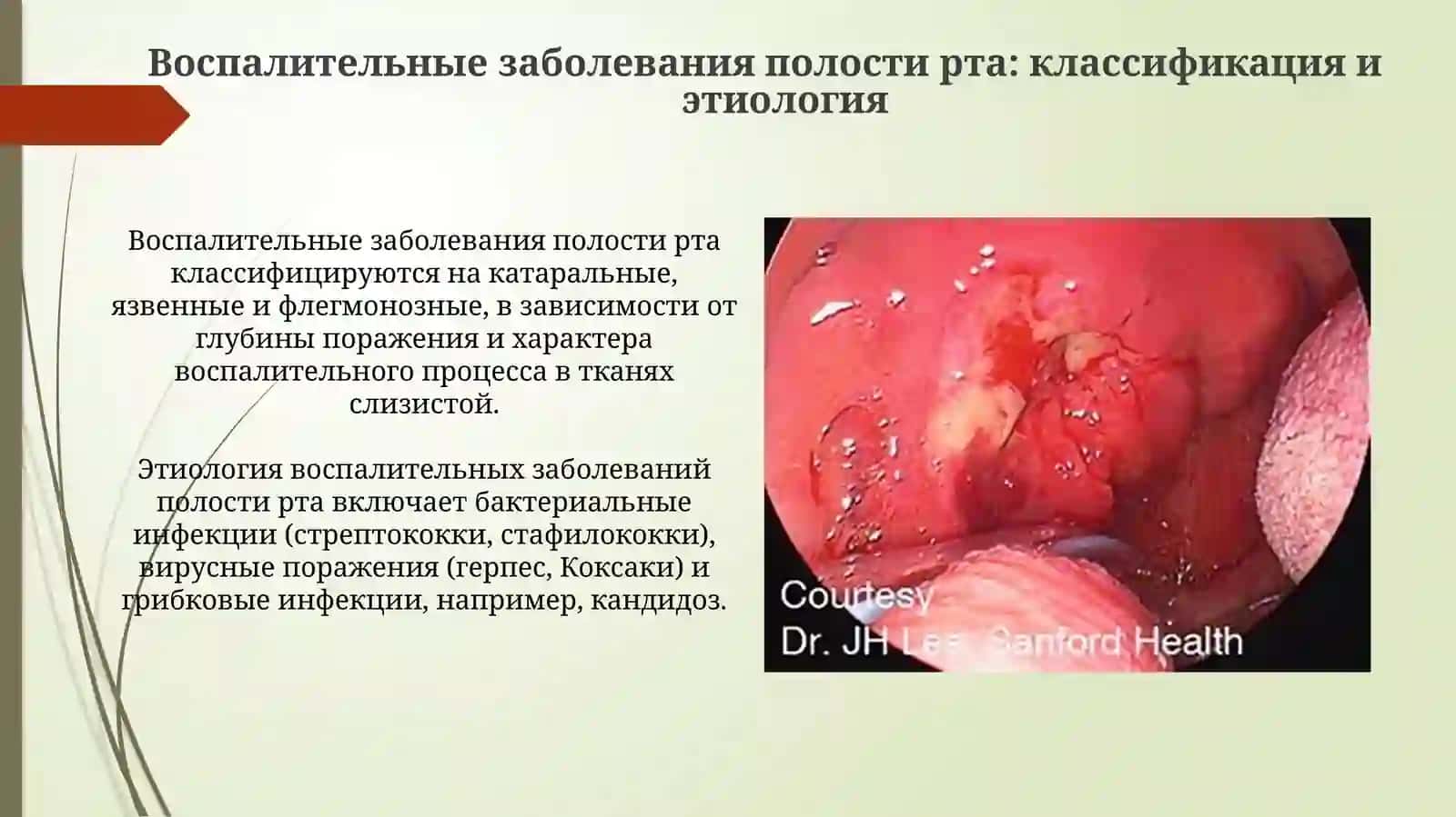 Патологическая анатомия 4