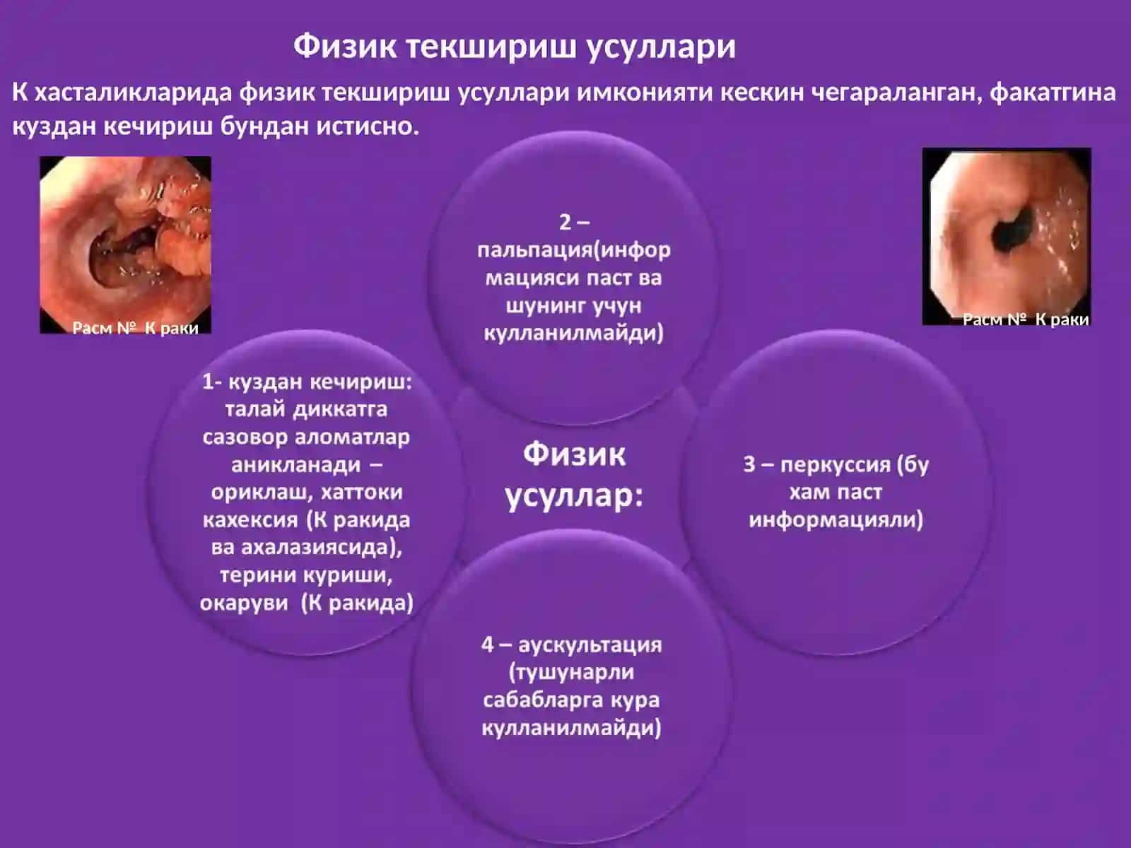 Меъда-ичак тракти касалликларини текшириш: сураб-суриштириш,куздан кечириш, пайпаслаш. Лаборатор ва инструментал текширишлар тугрисида тушунча. Асосий синдромлар. Уткир ва сурункали гастритлар симптоматологияси. 4
