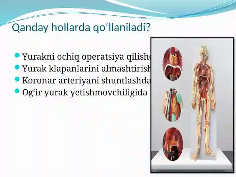 Sun’iy qon aylanish,sun’iy o’pka gemodializ apparatlari 4