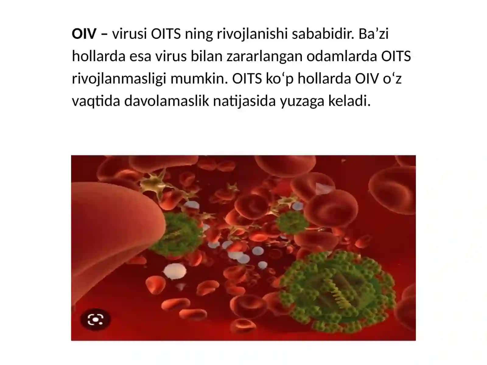 Spidvavichprofilaktikasi 4