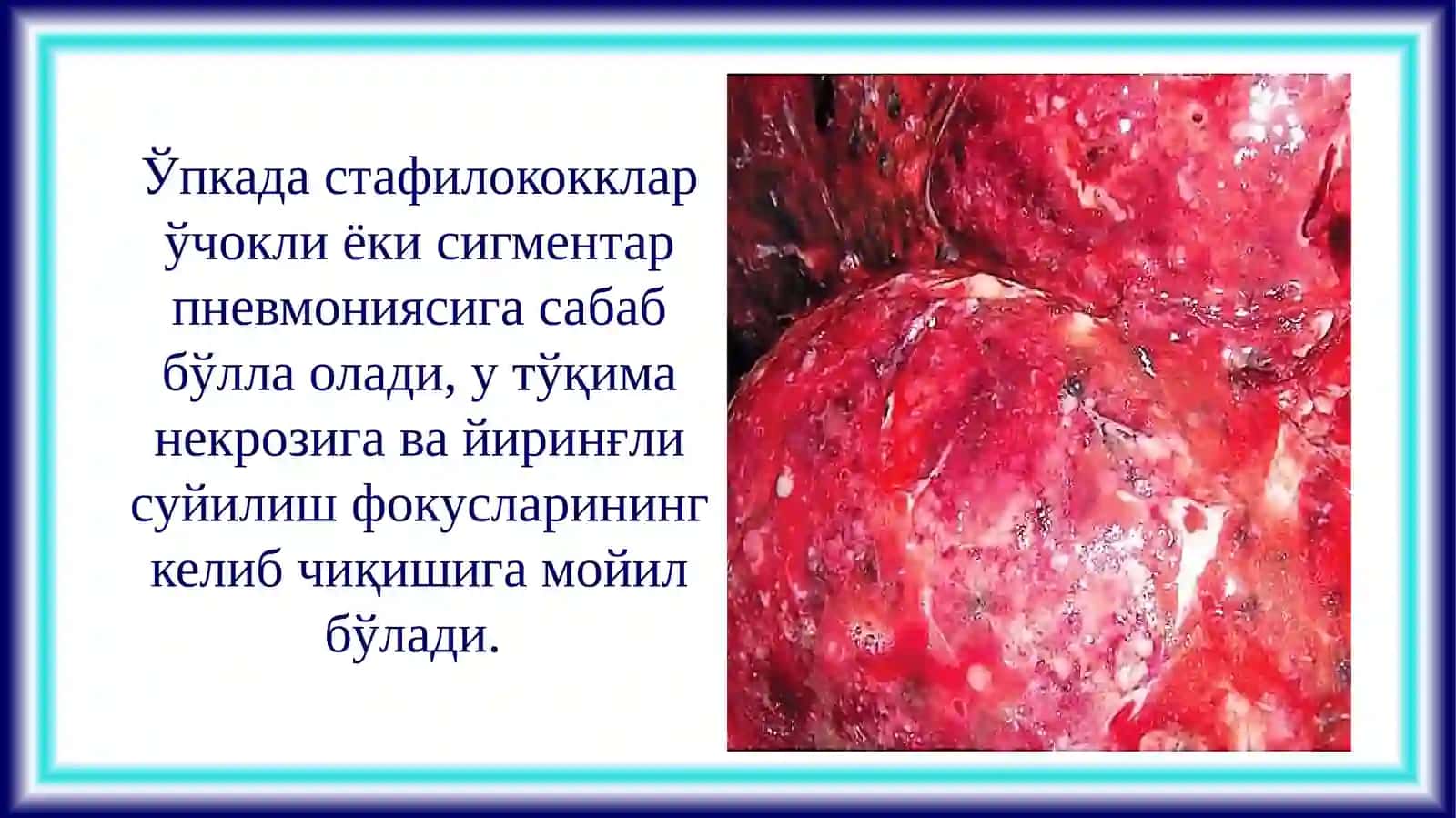 ПАТОЛОГИК АНАТОМИЯ ВА СУД ТИББИЁТИ 4