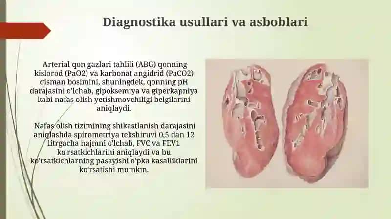 Konchlarda nafas olish tizimini baholash 4