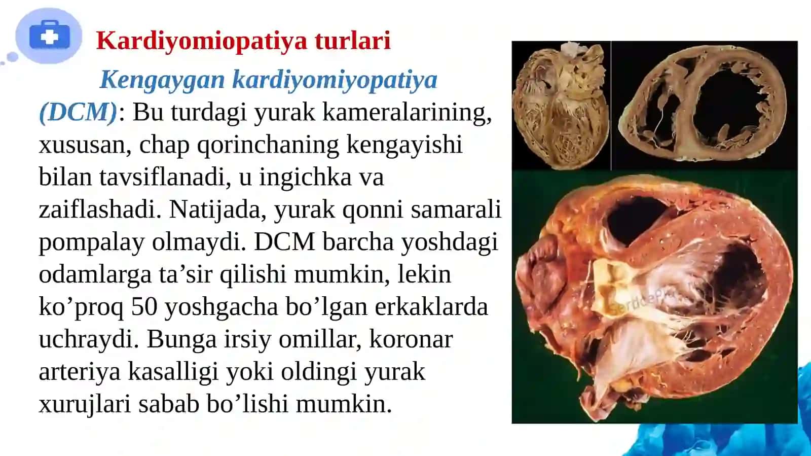 Kardiomiopatiyalar. Prion kasalliklari 4