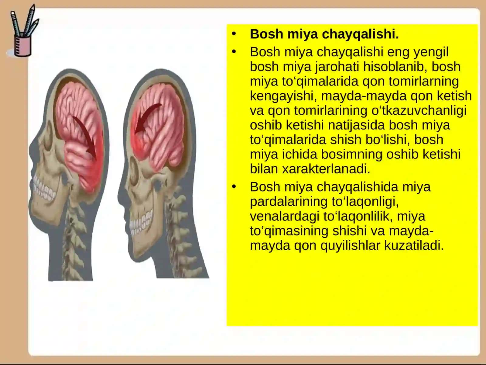 Bosh miya shikastlanganda birinchi yordam ko`rsatish 4