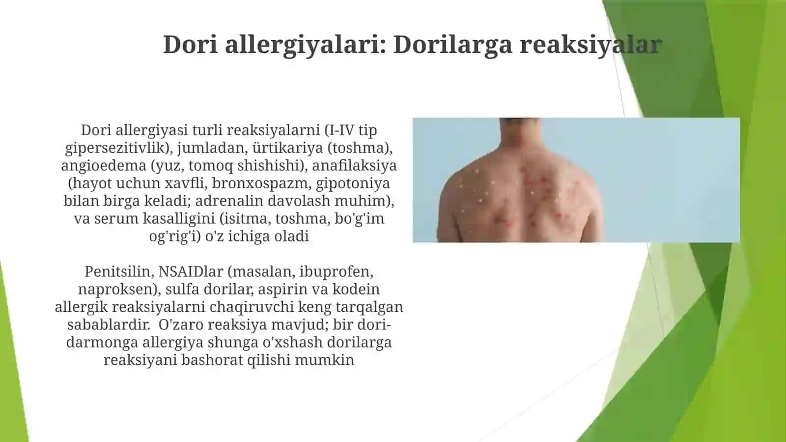 Alergik reaksiyalari 4