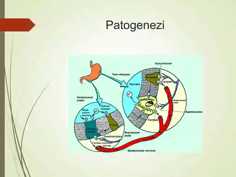 gastrit 4