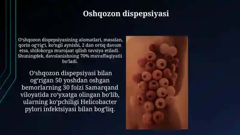Oshqozon kasalliklari 4