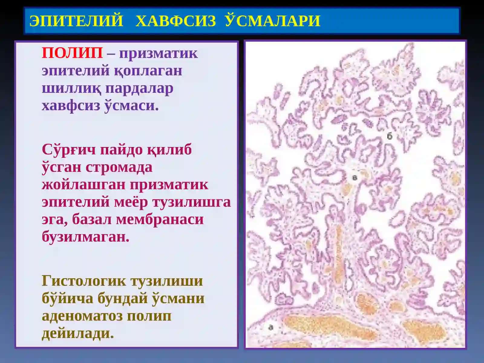 ЭПИТЕЛИЙ ХАВФСИЗЎСМАЛАРИ 4