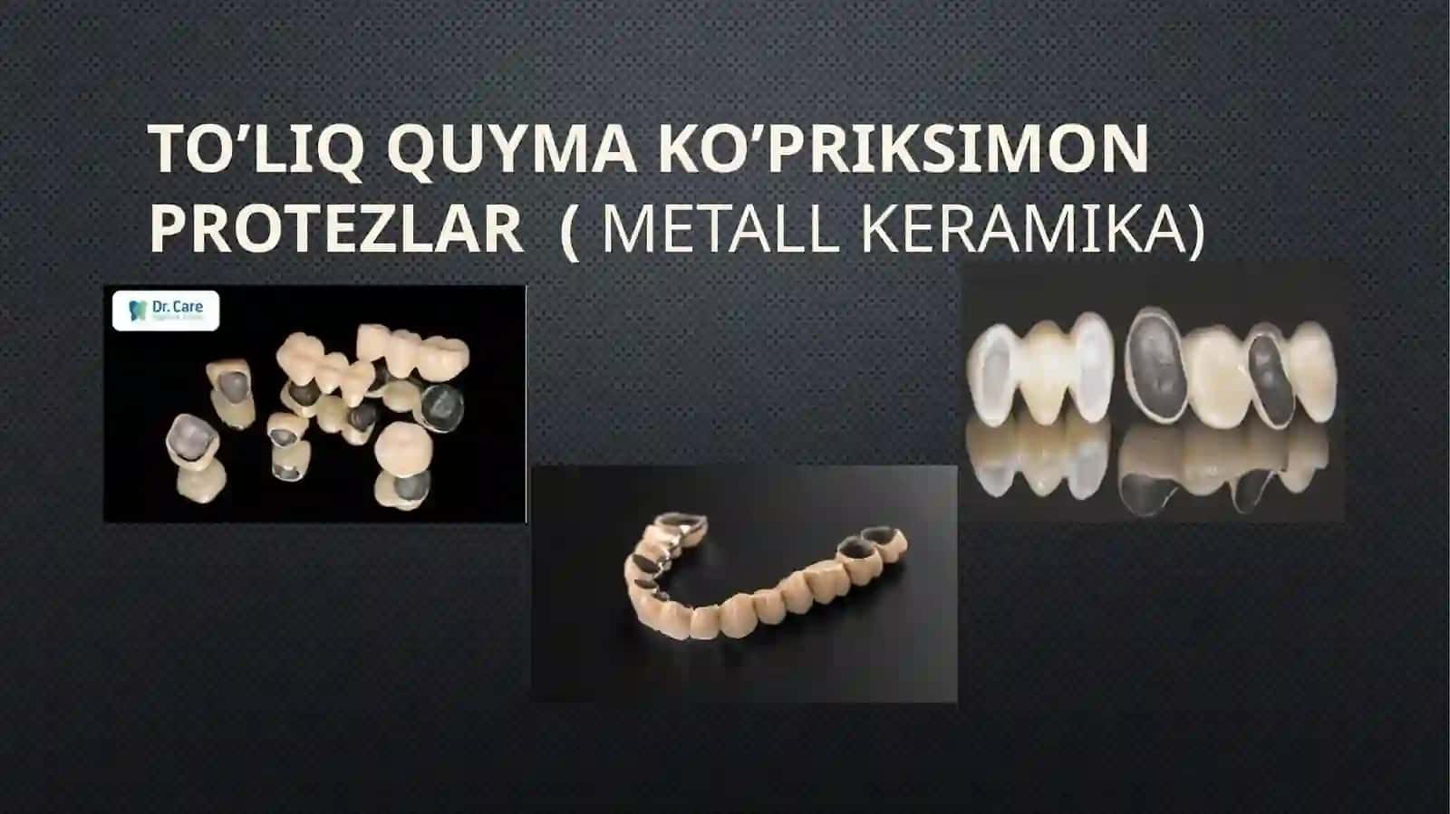 Zamonaviy Ko'priksimon protezlar 4